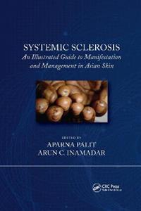 Systemic Sclerosis