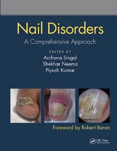 Nail Disorders - Click Image to Close