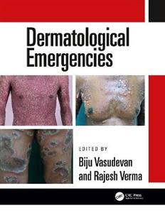 Dermatological Emergencies - Click Image to Close