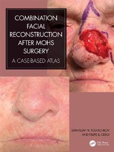 Combination Facial Reconstruction after Mohs Surgery: A Case Based Atlas - Click Image to Close