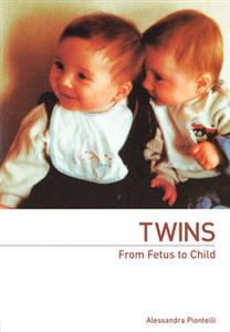 Twins - From Fetus to Child - Click Image to Close