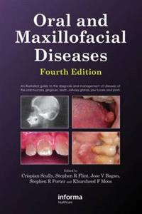 Oral and Maxillofacial Diseases, Fourth Edition