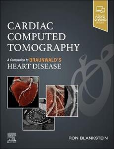 Cardiac Computed Tomography: A Companion to Braunwald's Heart Disease