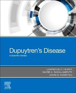 Dupuytren's Disease: A Scientific Review - Click Image to Close