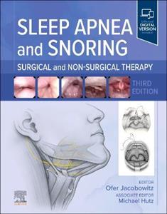 Sleep Apnea and Snoring: Surgical and Non-Surgical Therapy Sleep Apnea and Snoring: Surgical and Non-Surgical Therapy