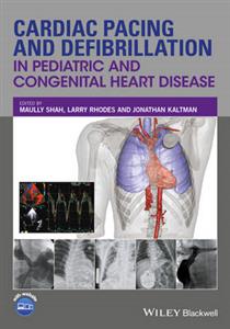 Cardiac Pacing and Defibrillation in Pediatric and Congenital Heart Disease - Click Image to Close