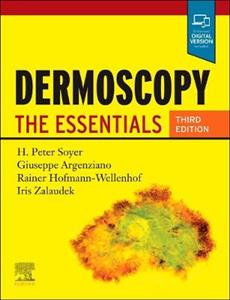 Dermoscopy 3e: The Essentials - Click Image to Close