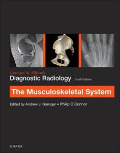 Grainger & Allison's Diagnostic Radiology: Musculoskeletal System - Click Image to Close