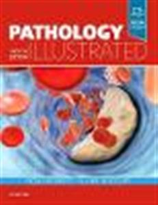 Pathology Illustrated - Click Image to Close