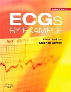 Ecgs by Example 3e