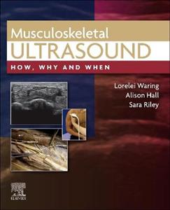 Musculoskeletal Ultrasound - Click Image to Close