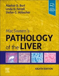 MacSween's Pathology of the Liver 8E - Click Image to Close