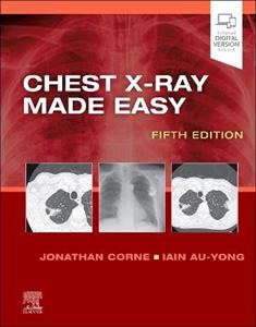 Chest X-Ray Made Easy 5E - Click Image to Close