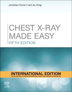 Chest X-Ray Made Easy - Click Image to Close