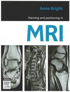 Planning and Positioning in MRI