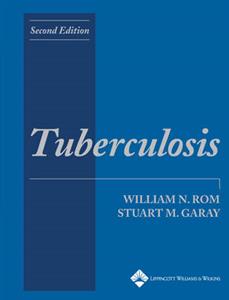 TUBERCULOSIS