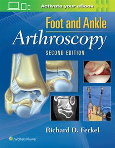 Foot amp; Ankle Arthroscopy