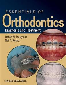 Essentials of Orthodontics: Diagnosis and Treatment