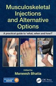 Musculoskeletal Injections and Alternative Options