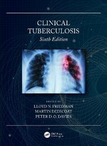 Clinical Tuberculosis - Click Image to Close