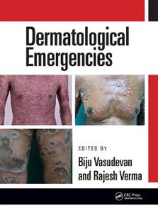 Dermatological Emergencies - Click Image to Close