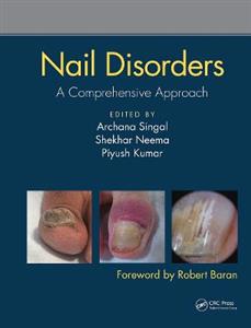 Nail Disorders - Click Image to Close