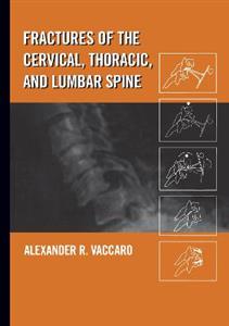 Fractures of the Cervical, Thoracic, and Lumbar Spine - Click Image to Close