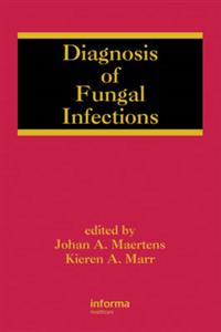 Diagnosis of Fungal Infections