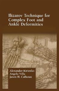 Ilizarov Technique for Complex Foot and Ankle Deformities