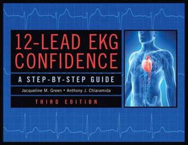 12-Lead Ekg Confidence: A Step-by-Step Guide - Click Image to Close