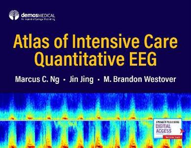 Atlas of Intensive Care Quantitative EEG