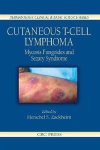 Cutaneous T-Cell Lymphoma