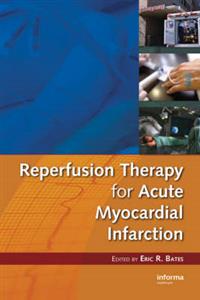 Reperfusion Therapy for Acute Myocardial Infarction