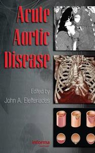 Acute Aortic Disease - Click Image to Close