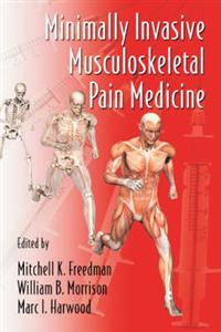 Minimally Invasive Musculoskeletal Pain Medicine