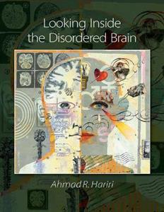 Looking Inside The Disordered Brain - Click Image to Close