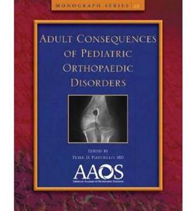 Adult Consequences of Pediatric Orthopaedic Disorders