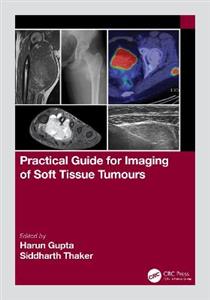 Practical Guide for Imaging of Soft Tissue Tumours - Click Image to Close