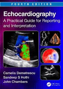 Echocardiography: A Practical Guide for Reporting and Interpretation - Click Image to Close