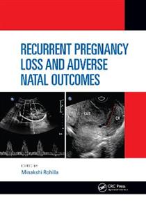 Recurrent Pregnancy Loss and Adverse Natal Outcomes - Click Image to Close