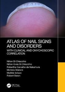 Atlas of Nail Signs and Disorders with Clinical and Onychoscopic Correlation - Click Image to Close