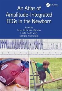 An Atlas of Amplitude-Integrated EEGs in the Newborn