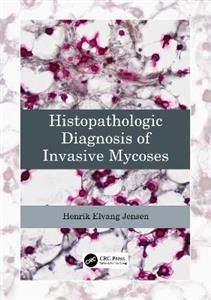 Histopathologic Diagnosis of Invasive Mycoses - Click Image to Close