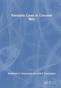 Paediatric Cases in Coloured Skin - Click Image to Close