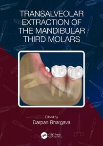 Transalveolar Extraction of the Mandibular Third Molars - Click Image to Close