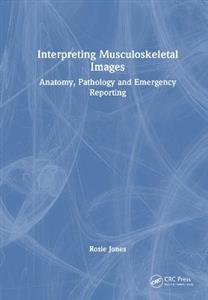 Interpreting Musculoskeletal Images: Anatomy, Pathology and Emergency Reporting - Click Image to Close