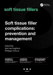 Soft Tissue Filler Complications: Prevention and Management