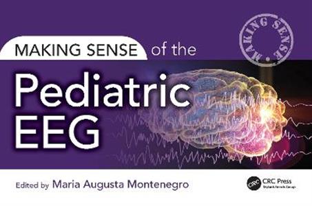 Making Sense of the Pediatric EEG - Click Image to Close