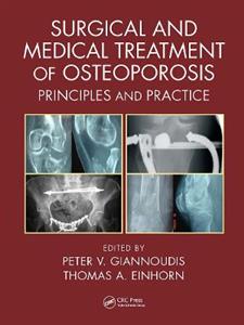 Surgical and Medical Treatment of Osteoporosis: Principles and Practice - Click Image to Close