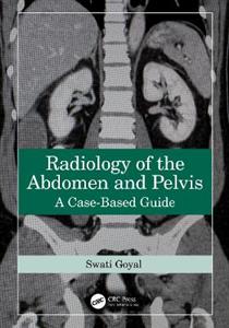 Radiology of the Abdomen and Pelvis: A Case-Based Guide - Click Image to Close